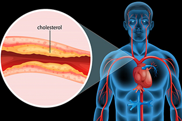 கெட்ட கொலஸ்ட்ராலை அடியோடு விரட்ட வேண்டுமா? இந்த ஒரு பொடியை மட்டும் சாப்பிடுங்க | Cholesterol Control Best House Remedy Powder கெட்ட கொலஸ்ட்ராலை அடியோடு விரட்ட வேண்டுமா? இந்த ஒரு பொடியை மட்டும் சாப்பிடுங்க | Cholesterol Control Best House Remedy Powder