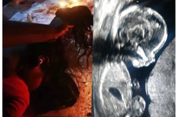 மந்திரவாதியால் அலறித் துடித்த கர்ப்பிணி...  பெண்னின் தலையை பார்த்து அதிர்ந்து போன மருத்துவர்கள்... ஏன் தெரியுமா?