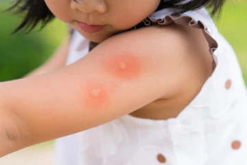 குழந்தைகளுக்கு ஏற்பட்டுள்ள ஆபத்து! மருத்துவர்கள் விடுத்துள்ள எச்சரிக்கை