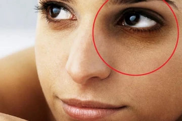 எப்பேர்ப்பட்ட கருவளையத்தையும் தடம் தெரியாமலாக்கும் ஐந்து வகையான பியூட்டி டிப்ஸ்!