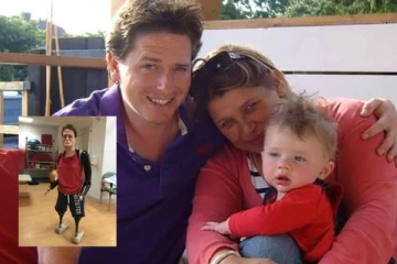 வெறும் காய்ச்சல் என கருதிய பிரித்தானியர்... கை, கால்களை இழந்த கொடூரம்: பீதியை ஏற்படுத்தும் Strep A