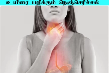 இரவில் நெஞ்செரிச்சலால் அவதியா? உயிரையும் பறிக்கும்... அலட்சியப்படுத்தாதீங்க
