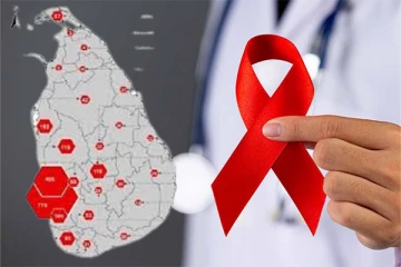 இலங்கையில் அதிகரித்து வரும் எச்.ஐ.வி நோயாளர்களின் எண்ணிக்கை ; மருத்துவ நிபுணர் வெளியிட்ட தகவல்