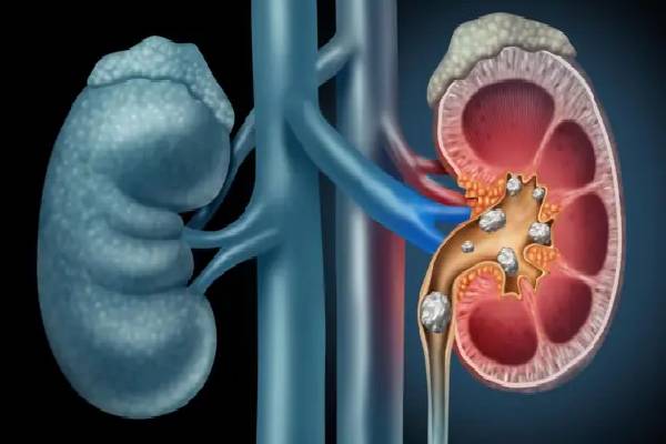 யாரெல்லாம் ஆரஞ்சு பழம் சாப்பிடக்கூடாது தெரியுமா? | Do You Know Who Shouldn T Eat Oranges யாரெல்லாம் ஆரஞ்சு பழம் சாப்பிடக்கூடாது தெரியுமா? | Do You Know Who Shouldn T Eat Oranges