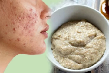 முகப்பருவை நிரந்தரமாக நீக்க உதவும் பேஸ்பேக்.., எப்படி தயாரிப்பது?