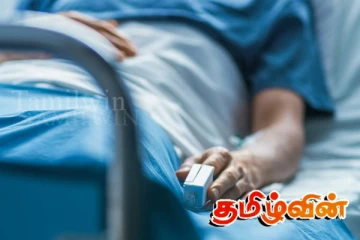 இலங்கையில் பரவும் மற்றுமொரு நோய் தொற்று