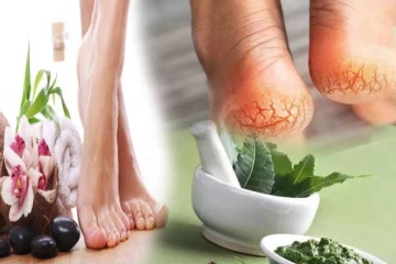 குதிக்கால் வெடிப்புக்கு முடிவு கட்டனுமா? அப்போ இத ட்ரை பண்ணுங்க