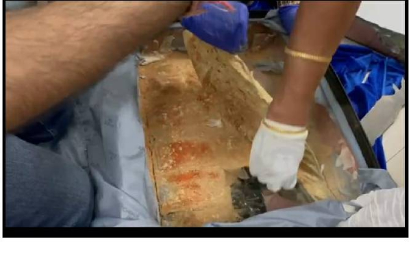 சென்னை விமான நிலையத்தில் 2 சர்வேதேச கடத்தல்காரர்கள் கைது | Tansaniya Chennai International Drug Dealers