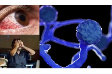 கொரோனாவைத் தொடர்ந்து அதிகரிக்கும் கருப்பு பூஞ்சை - அமைச்சர் சொன்ன அதிர்ச்சி தகவல்!