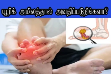 யூரிக் அமிலத்தால் அவதிப்படுறீங்களா? அப்போ இதையெல்லாம் கட்டாயம் கடைப்பிடிங்க