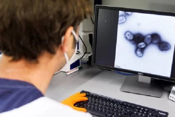 வேகமெடுக்கும் Monkeypox பரவல்... முதல் முறையாக வேல்ஸில் பாதிப்பு உறுதி