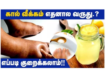 கால் வீக்கம் எதனால வருது? எப்படி குறைக்கலாம்? வீடியோ செய்தி