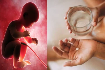 கருக்கலைப்பு மாத்திரையால் நேர்ந்த விபரீதம் - பெண்ணின் வயிற்றில் எற்பட்ட வினோதம்!