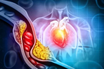 கொலஸ்ட்ரால் அளவை உடனடியாக குறைக்க வேண்டுமா? அப்போ இந்த இயற்கை பானத்தை மறக்காமல் எடுத்துகோங்க