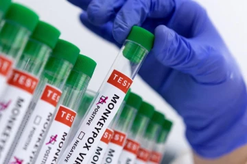 குரங்கம்மை தொடர்பில் சுகாதார அமைச்சின் அறிவிப்பு