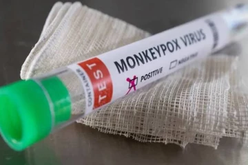 இலங்கையின் அண்டை நாட்டில் 2வது நபருக்கும் குரங்கம்மை தொற்று உறுதி!