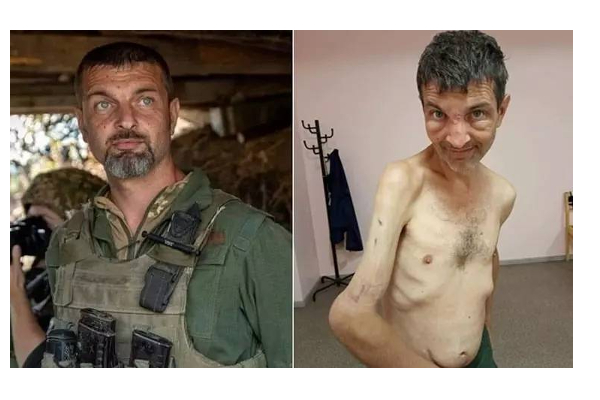 ரஷ்யாவிடம் கைதியாக சிக்கிய உக்ரைன் வீரரின் தற்போதைய பரிதாப நிலை! அதிர்ச்சி தரும் புகைப்படம் | Soldier Released Russians Torture Shocking Photos