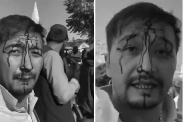 தலையில் ரத்தம் வடிய வடிய தாக்கிய தலிபான்கள்... காபூலில் ஆஸ்திரேலியருக்கு நேர்ந்த பயங்கரம்! பதற வைக்கும் காட்சி