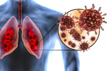 ඉන්ධන, ගෑස්, විදුලි අර්බුද මැද වසංගතයකුත් හිස ඔසවයි