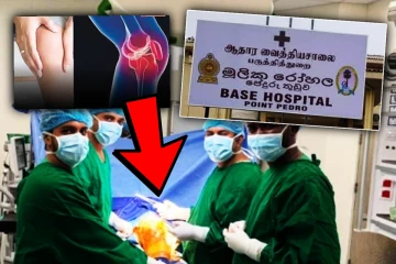 யாழ். பருத்தித்துறை வைத்தியசாலையின் வரலாற்றுச் சாதனை