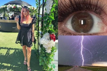 மின்னல் தாக்கியதால் நிறம் மாறிய கண்கள்! பரவசமாக உணர்ந்ததாக அனுபவத்தை பகிர்ந்த பெண்