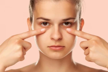 கருவளையங்கள் அழகை பாதிக்கின்றதா? இயற்கையான எளிய வழிமுறை இதோ