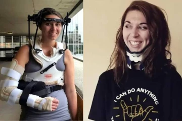 துண்டிக்கப்பட்ட தலையை மீண்டும் முதுகெலும்புடன் இணைத்து சாதித்த மருத்துவர்கள்