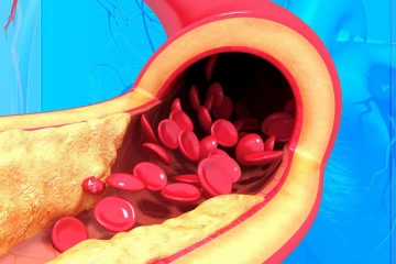 கெட்ட கொழுப்பை ஒரே நாளில் கரைத்து விரட்டும் சக்திவாய்ந்த பழங்கள்! தினமும் சாப்பிட்டால் என்ன நடக்கும் தெரியுமா?