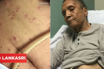 முதியோர் இல்லத்திலிருந்த இராணுவ வீரரை கடித்தே கொன்ற நெருப்பு எறும்புகள்... வழக்கு தொடர்ந்துள்ள உறவினர்கள்