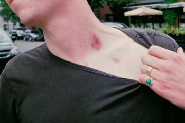 ආදරේට දුන්න Love Bite එකෙන් තරුණයෙක් ජීවිතෙන්ම සමු ගෙන - රටක්ම කළඹපු මරණය