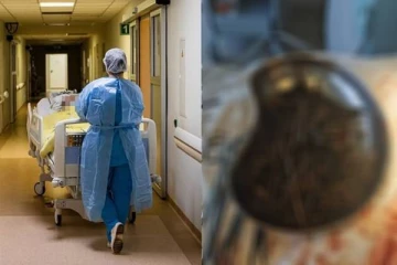 இளைஞரின் வயிற்றில் கொத்து கொத்தாக கிடந்த மர்ம பொருட்கள்.. ஸ்கேனை பார்த்து மிரண்டுபோன மருத்துவர்கள்