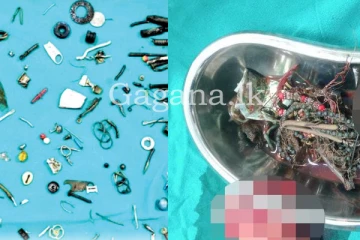 පුද්ගලයාගේ ආමාශයෙන් කුඩා භාණ්ඩ 60 ක් සොයා ගැනේ. (PHOTOS)