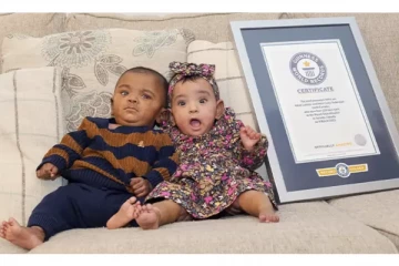 பிறக்கும்போதே கின்னஸ் உலக சாதனை பெற்ற இரட்டைக் குழந்தைகள்!