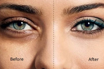 கண்களுக்கு கீழ் கருவளையத்தை போக்கும் உளுந்து பேக்! இப்படி பயன்படுத்தினாலே போதும் ?