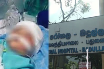 இலங்கையில் நடந்த அபூர்வ சத்திரசிகிச்சை - உயிர் தப்பிய பெண்
