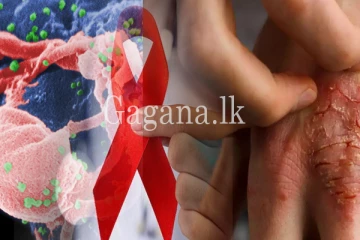 එන්න එන්නම මෙරට HIV ආසාදිතයන්ගේ සංඛ්‍යාව සහ මරණ සංඛ්‍යව ඉහළට.