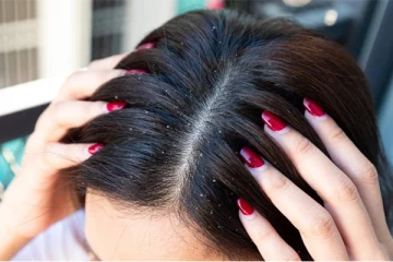 பொடுகு பிரச்சினையால் தொடர்ந்தும் உங்கள் முடி உதிர்ந்துக் கொண்டே இருக்கிறதா? இனி வாரத்தில் இரண்டு தடவை பயன்படுத்தி பாருங்கள்!