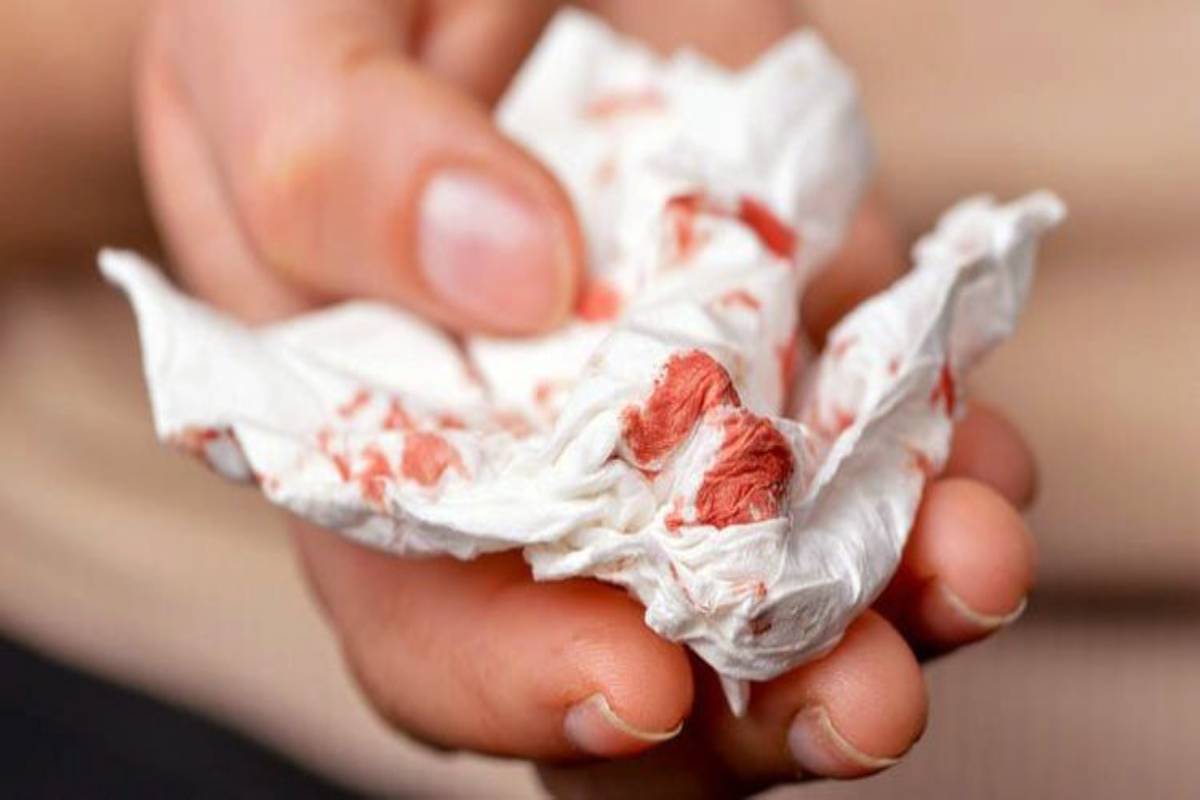 காசநோயின் ஆரம்ப அறிகுறிகள் என்னென்ன? இதை மட்டும் புறக்கணிக்காதீங்க | What Are The Early Symptoms Of Tuberculosis