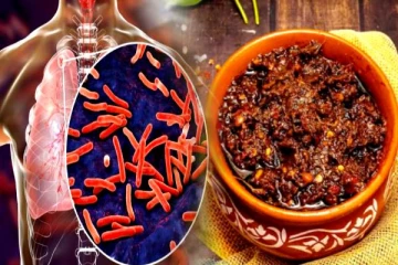 காசநோயை குணப்படுத்தும் கோங்குரா ஊறுகாய்.. இனி பொருளை மட்டும் பார்த்து போடுங்க!