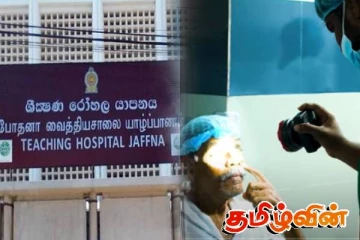 யாழ்.போதனா வைத்தியசாலையில் கண் சிகிச்சை பிரிவு! வெளியான உண்மைகள்