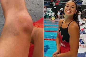 நீச்சல் போட்டிக்காக சென்றபோது திடீரென மயக்கமடைந்த கனேடிய இளம்பெண்... கண் விழித்தபோது உடலில் இருந்த காயங்கள்