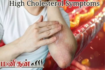உடலில் கெட்ட கொழுப்பு அதிகரித்தால் தோலில் காட்டும் அறிகுறிகள் என்ன?
