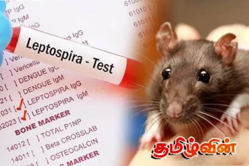 எலிக்காய்ச்சல் குறித்து விடுக்கப்பட்டுள்ள முக்கிய எச்சரிக்கை!