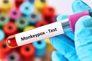 தென்னாபிரிக்காவினை அச்சுறுத்தும் மூன்று புதிய குரங்கு காய்ச்சல்