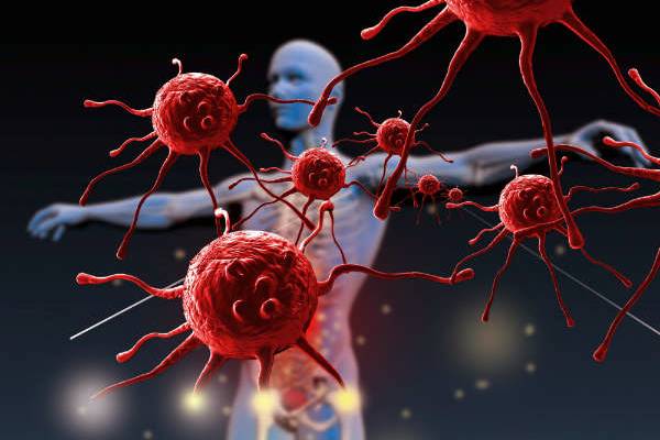 நாய் நக்குவதால் செப்சிஸ் எனப்படும் ஆபத்தான நோய் - இது எப்படி தொற்றும்? | Dog Lick Caused Dangerous Disease Sepsis Ymptoms