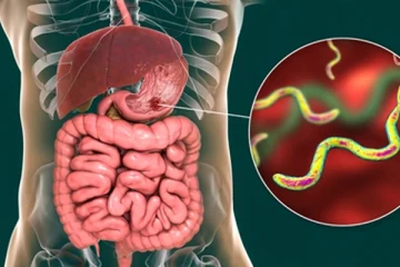 அல்சர் விரைவில் குணமாக வேண்டுமா? அப்போ அவசியம் இந்த பழங்களை சாப்பிடுங்க போதும்!