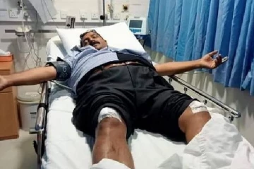 வடிவேல் மீதும் சரமாரியாக தாக்குதல்; வைத்தியசாலையில் அனுமதி
