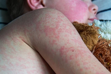 சுவிட்சர்லாந்தில் அதிகரித்துவரும் தொற்று: வெளிநாடுகளைக் கைகாட்டும் அதிகாரிகள்