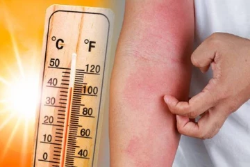 நாட்டில் அதிகரிக்கும் வெப்பநிலை! மக்களுக்கு விடுக்கப்பட்டுள்ள எச்சரிக்கை