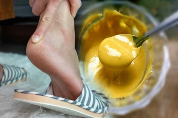 குதிகால் வெடிப்பை மின்னல் வேகத்தில் குறைக்கும் உடனடி மருந்து: கடலை மா மட்டும் போதுமா?